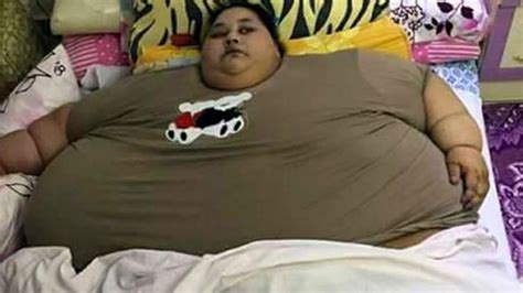 Dünyanın en şişman kadını 100 kilo verdi Internet Haber