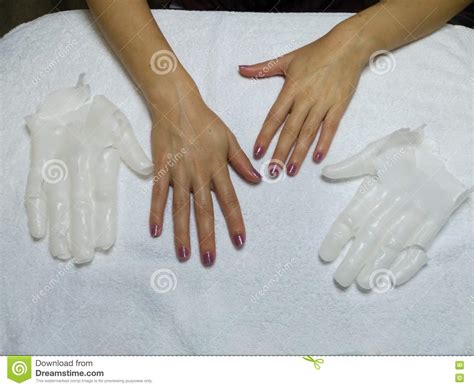 Woman Hands In Paraffin Wax With Paraffin Modeling Gloves Editorial