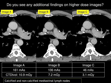 Ppt Image Gallery Lesion Detection On Low Dose Chest Ct Powerpoint Presentation Id