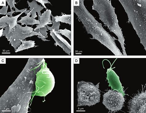 Scanning Electron Microscopy Of The Interaction Between Trichomonas