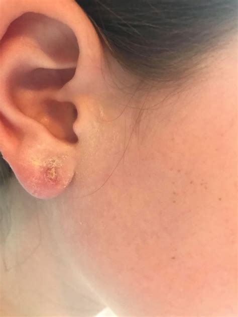 Mum Slams Claires Accessories For Daughters £45 Ear Piercing Becoming