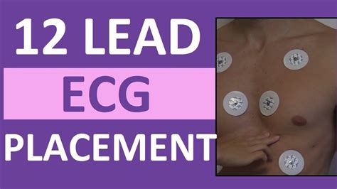 Lead Ecg Placement Of Electrodes Ekg Sticker Lead Procedure Youtube