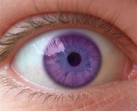 Violet Eyes Purple Eyes Disease Rare Eyes