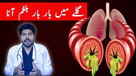 The 3 Main Causes Of Constant Mucus Phlegm In Your Throat Youtube