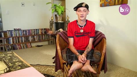 Man Born With No Thighs Due To Condition Only People In The World Suffer Has Learnt How To