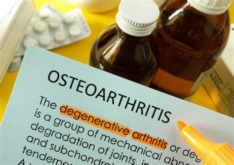 Osteoarthritis How To Treat It