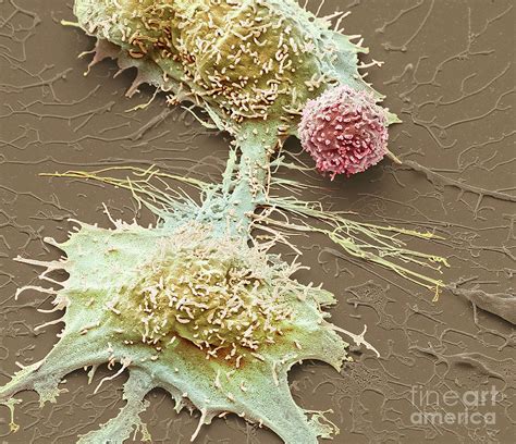 Natural Killer Cell And Cancer Cell Photograph By Steve Gschmeissner Science Photo Library