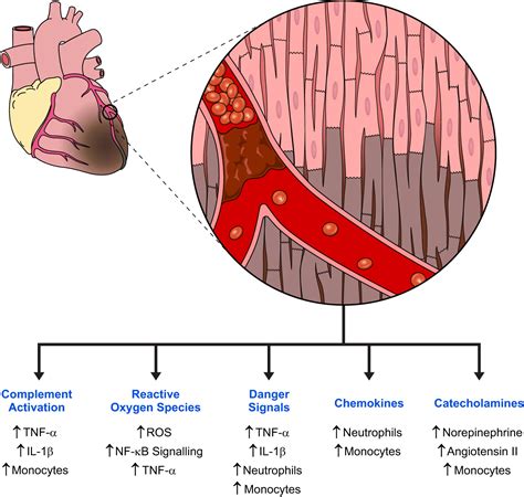 Inflammation In Myocardial Injury Mesenchymal Stem Cells As Potential