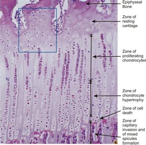 Long Bone Labeled Epiphyseal Plate Histology Of The Growth Plate The