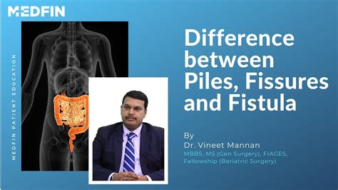 What Is The Difference Between Piles Fissures And Fistula Youtube
