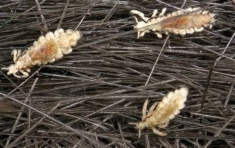 Head Lice Identification Guide Action Pest Control