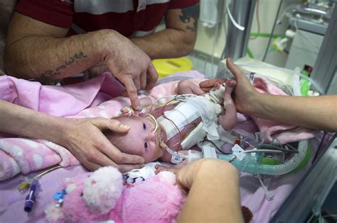 ‘miracle Baby Survives Being Born With Heart Outside Her Chest