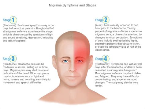 Bandw Newswire Migraine Symptoms And Stages