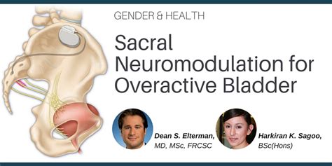 Sacral Neuromodulation For Overactive Bladder