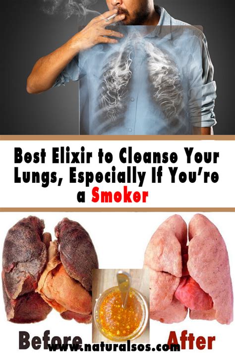So whether you once smoked or never puffed on. Pin on Health