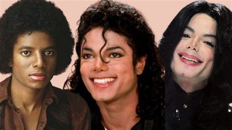 Vitíligo La Causa Del Blanqueamiento De Michael Jackson