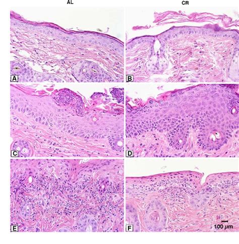 Histological Features Of The Skin From 8 Month Cr And Al Mice A B