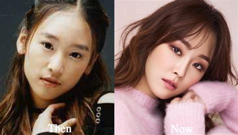 Korean actors look a like | mistylee100386's blog. Seo Hyun Jin Plastic Surgery Rumors Before and After ...