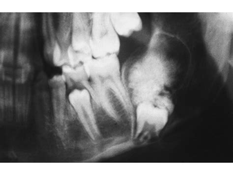 A Digital Manual For The Early Diagnosis Of Oral Neoplasia