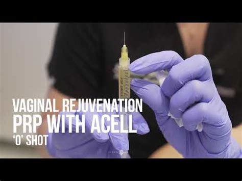 Increase Sexual Stimulation Vaginal Rejuvenation With Prp With Acell