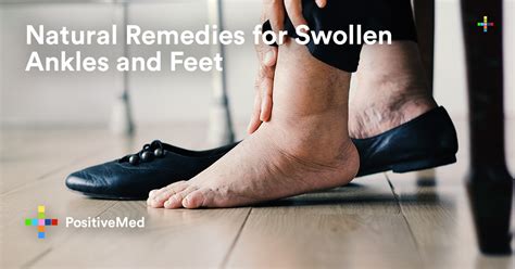 Natural Remedies For Swollen Ankles And Feet Positivemed