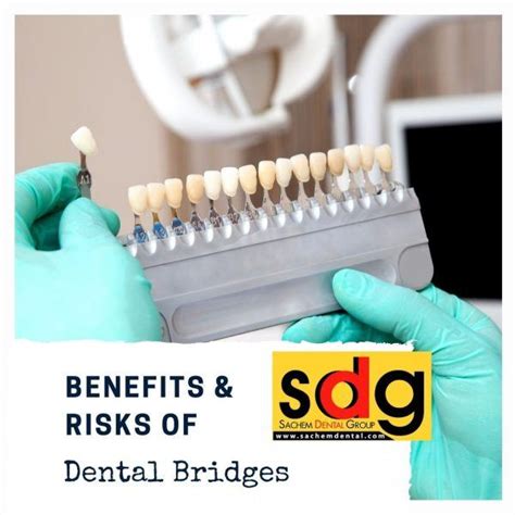 Benefits And Risks Of Dental Bridges Sachem Dental Group