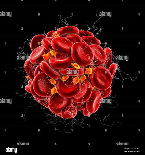 Blood Clot Illustration Stock Photo Alamy
