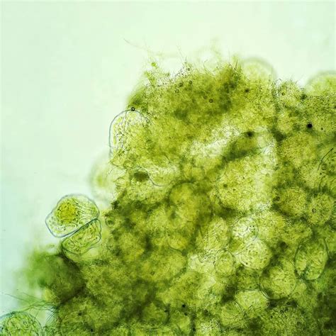 What Kind Of Algae Is It 🤔 Microscopy Microscope Biology