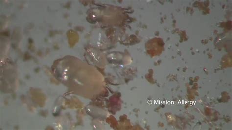 Dust Mites Under The Microscope In Hi Defmov Youtube