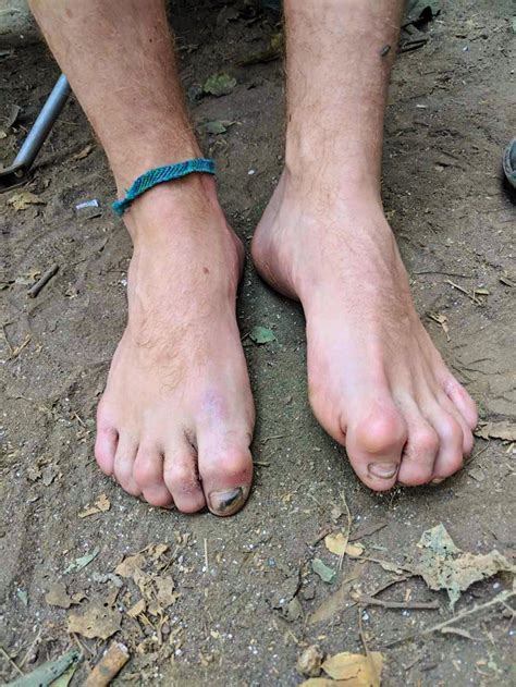 Re Gram 9 Photos Of Heinous Climber Feet