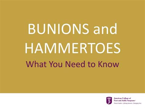 Ppt Bunions And Hammertoes Powerpoint Presentation Free Download