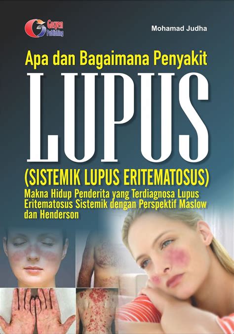 Apa Dan Bagaimana Penyakit Lupus Sistemik Lupus Eritematosus