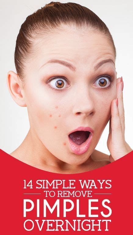 Miss Beauty 14 Simple Ways To Remove Pimples Overnight In 2020