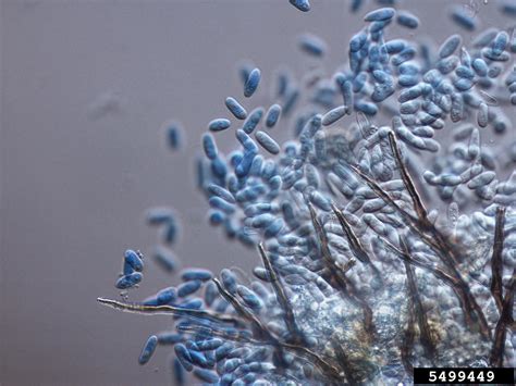 Bitter Rot And Anthracnose Colletotrichum Gloeosporioides