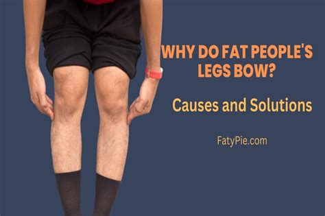 why do fat people s legs bow causes and solutions in 2023