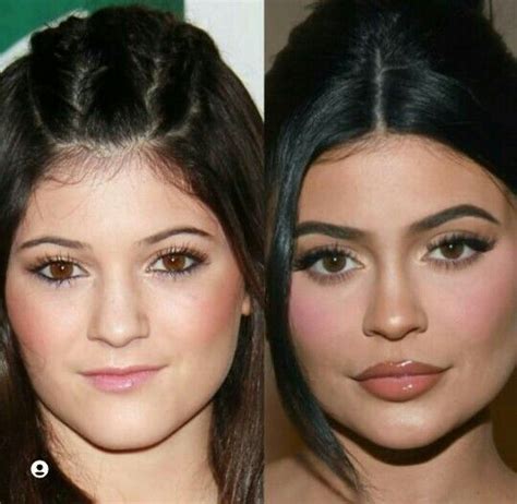 Pin By Gracie On Plastic Surgery Photoshop Before After Celebrities