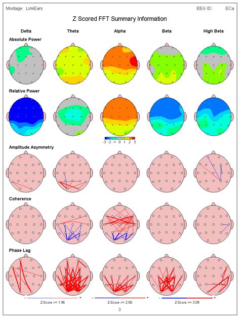 Qeeg Brain Mapping Scottsdale Neurofeedback Institute Az