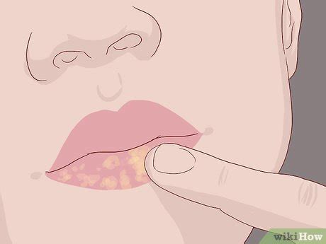 Cómo tener labios besables 13 Pasos con imágenes