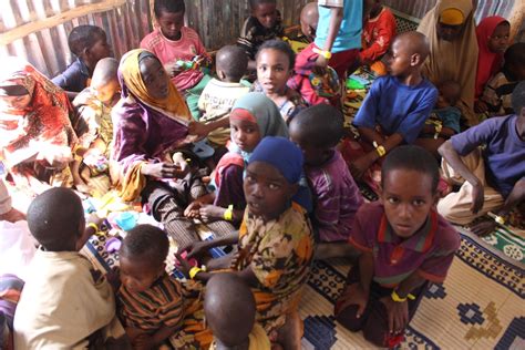 Etiópia Msf Vê A Desnutrição De Crianças Na Zona De Doolo Aumentar Dez Vezes Msf Brasil
