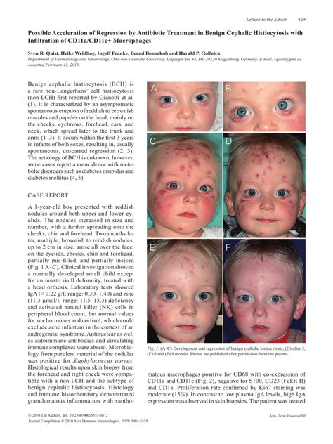 Pdf Possible Acceleration Of Regression By Antibiotic Treatment In