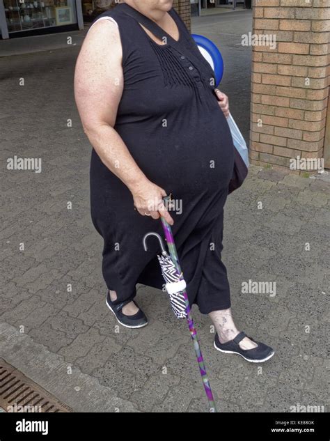 Large Fat Obese Person Woman With Walking Stick Truncated Viewed From