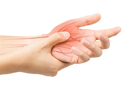 Carpal Tunnel Syndrome And Treatments Active Sports Therapy