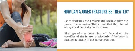 What Is A Jones Fracture All Your Questions Answered Here