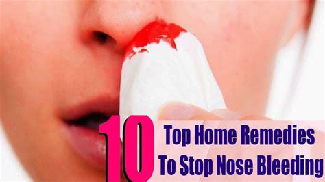 Nosebleed How To Stop A Nosebleed Fast 5 Ayurvedic Home Remedies Prevention Youtube