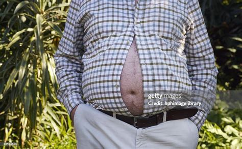 Man With His Large Belly Bursting Through His Shirt Photo Getty Images