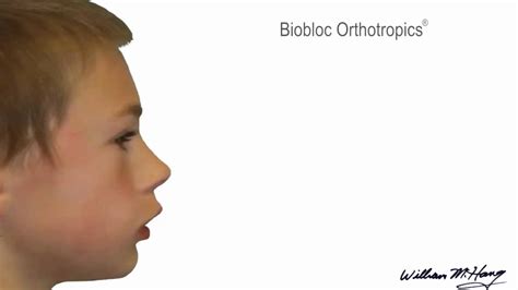 Biobloc Orthotropics By Dr William Hang Youtube