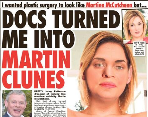 Sunday Sport On Twitter Docs Turned Me Into Martin Clunes Read The