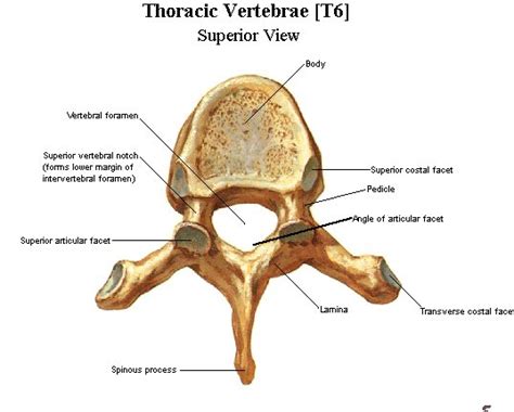 The catheter is used to inject the fractured vertebrae with bone cement, which hardens, stabilizing the vertebral column. Vertebrae