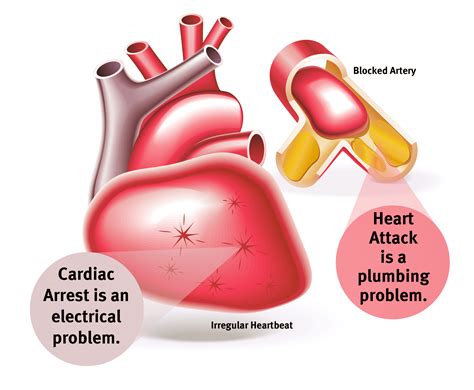 The Differences Of The Cardiac Arrest Vs Heart Attack Disease