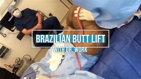 Brazilian Butt Lift With Dr Work Youtube